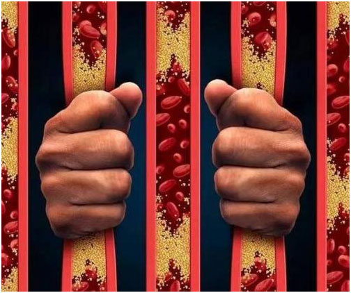 腦血栓,心腦血管疾病