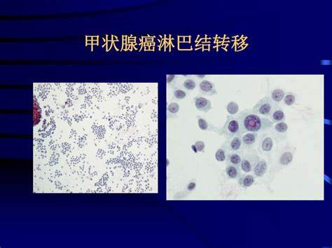 OIPUCPC45I3.jpg