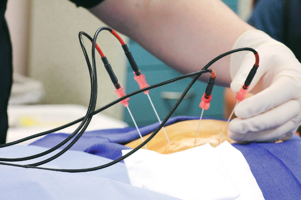 1634089139258154.jpg medworld-clinic-radiofrequency-1024x683-1.jpg