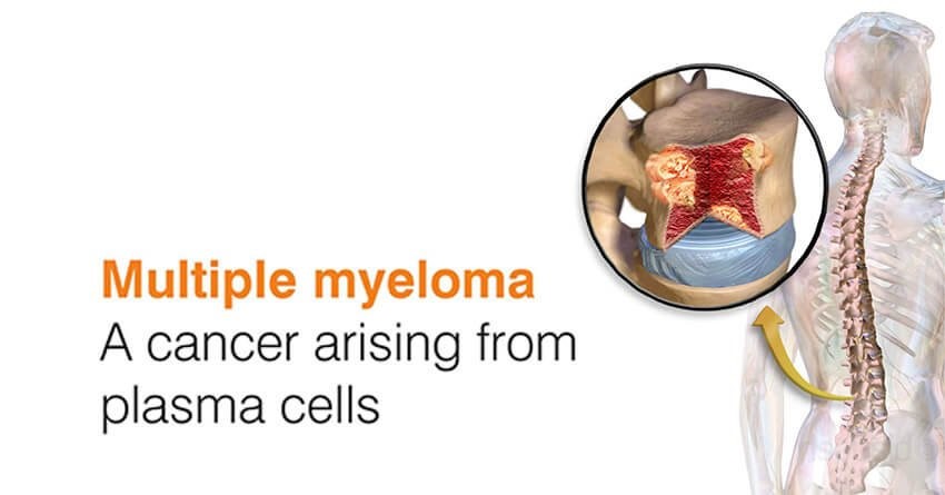 1634264855566187.jpg MM9 (3).jpg