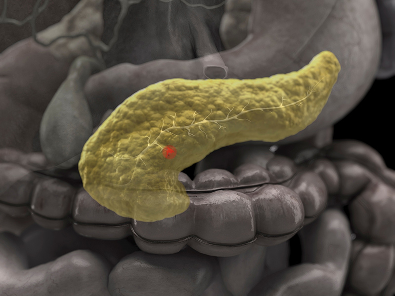 1635990458840588.jpg 1111e.jpg