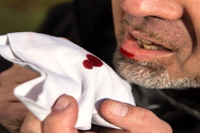 1635990595231355.jpg Hemoptysis.jpg