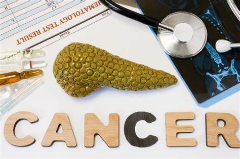 1637546954309540.jpg 胰腺癌0l.jpg